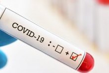 Le Copil Coronavirus dénonce le trafic de faux résultats Covid-19 au Gabon
