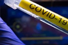 Coronavirus : le nombre de cas en Afrique multiplié par deux en une semaine (OMS)
