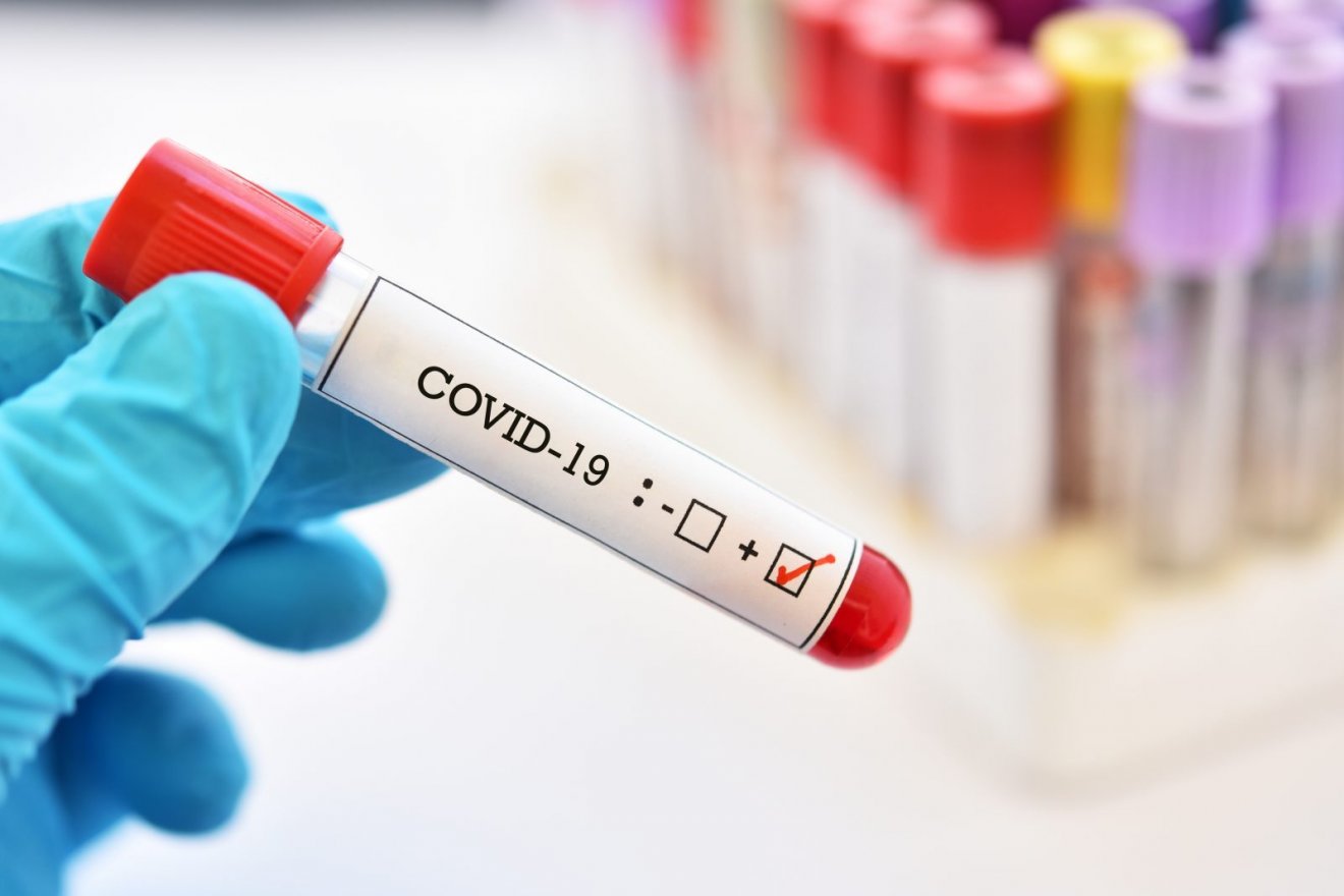 Le Copil Coronavirus dénonce le trafic de faux résultats Covid-19 au Gabon
