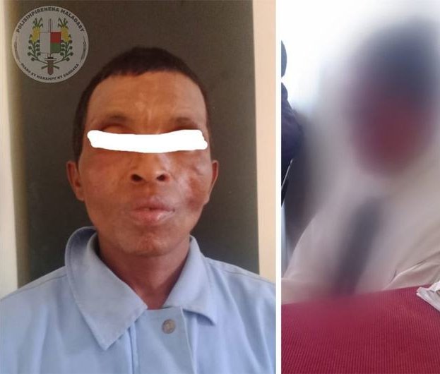 Madagascar : Une jeune fille de 12 ans fait arrêter son violeur de beau-père
