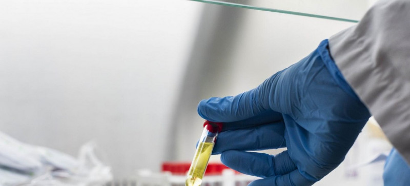Covid-19 : les tests rapides antigènes vont doper les capacités de dépistage en Afrique

